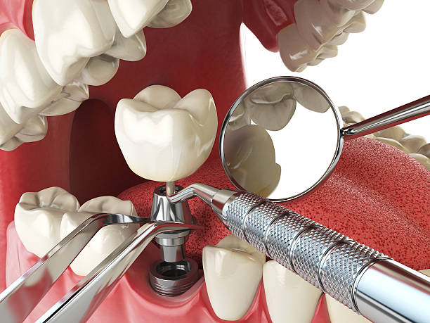 Best Emergency Dentist Open Today  in Lexington, IL